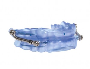 Oral appliance for treating sleep breathing disorders in Longview, TX