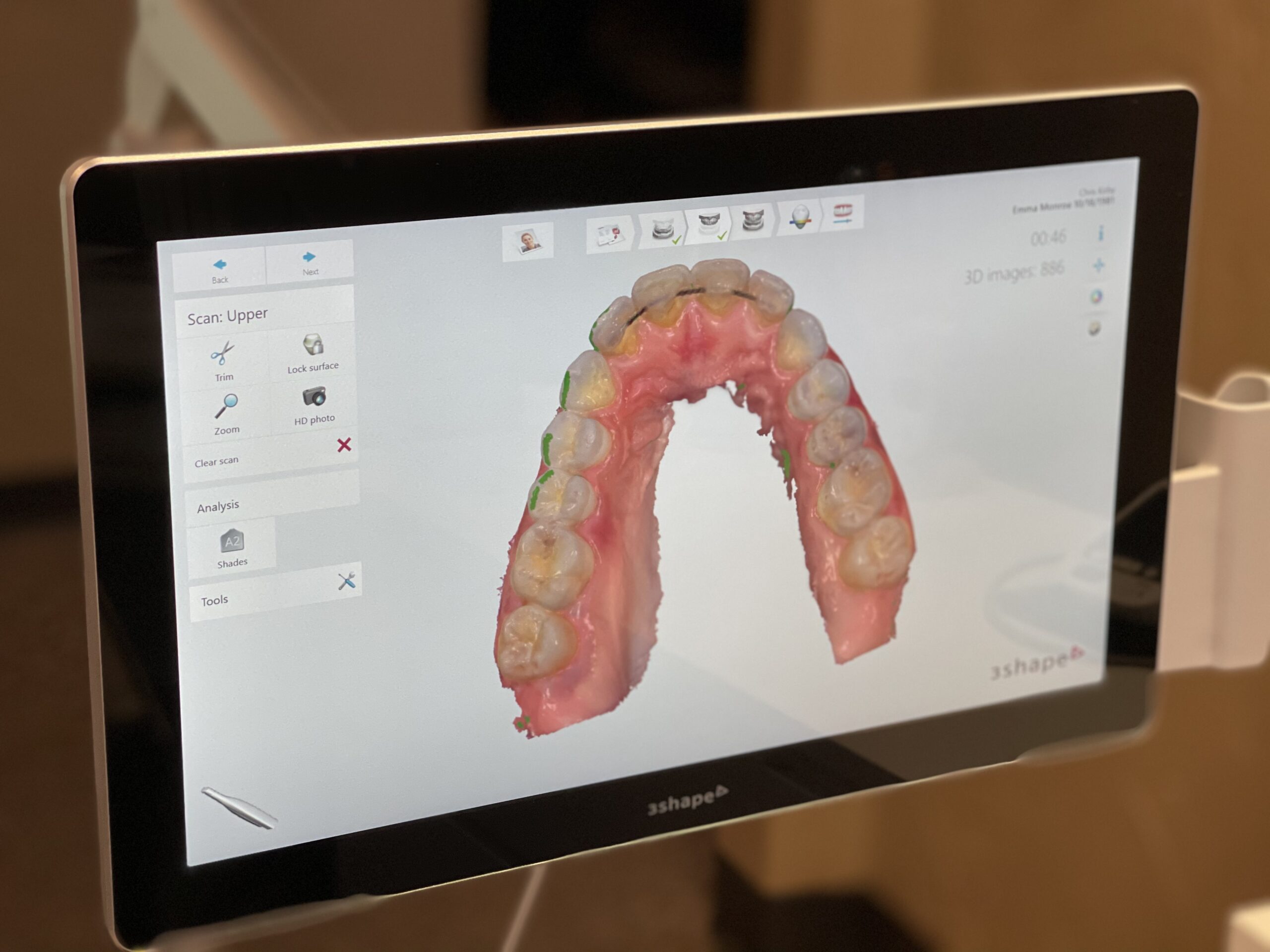A 3D scan of teeth on a computer monitor at Vaca and Kirby Dental in Longview, TX