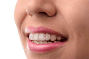 Woman wearing invisalign